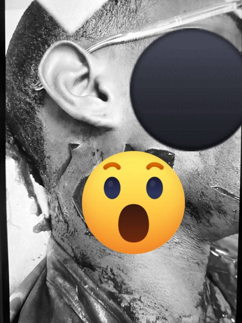 Madre denuncia variación de medida de coerción sin notificación en caso de agresión en Villa Hermosa.