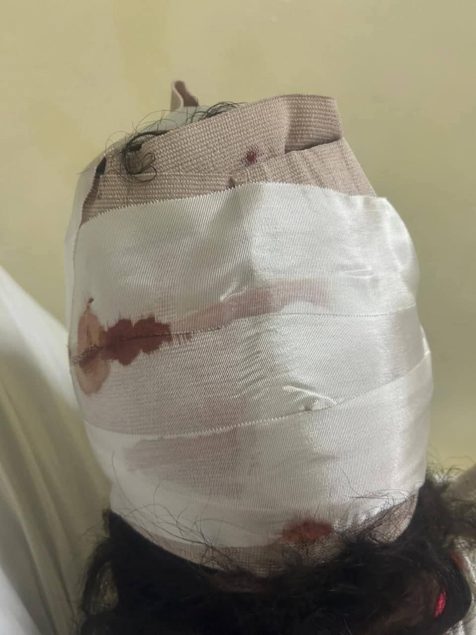 Mujer resulta gravemente herida tras presunta agresión de su pareja en La Romana.