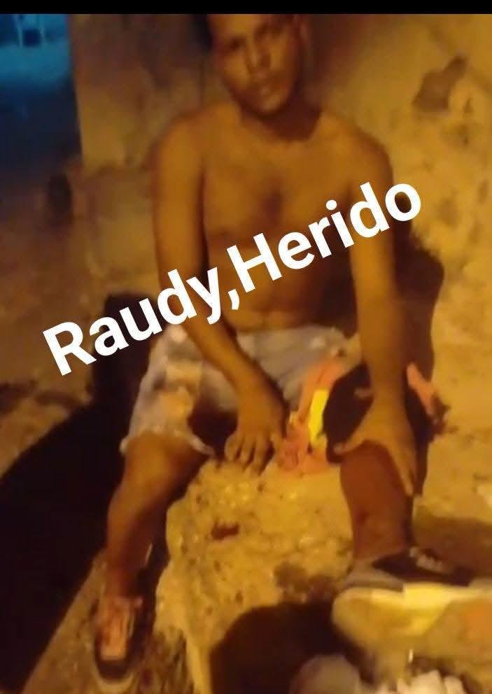 VIDEO DE JOVEN HERIDO DE BALA EN EL SECTOR CATANGA, LA ROMANA.